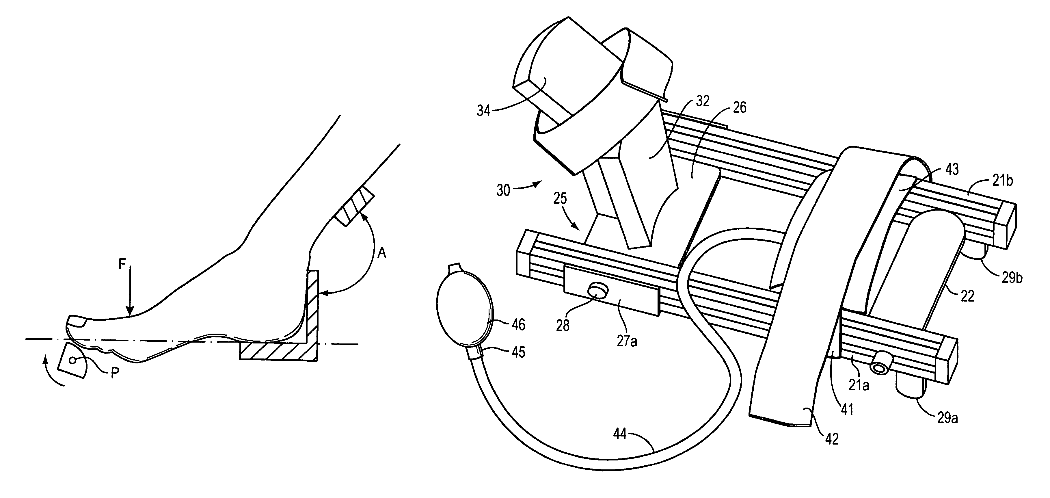 Method and apparatus for manipulating a toe joint
