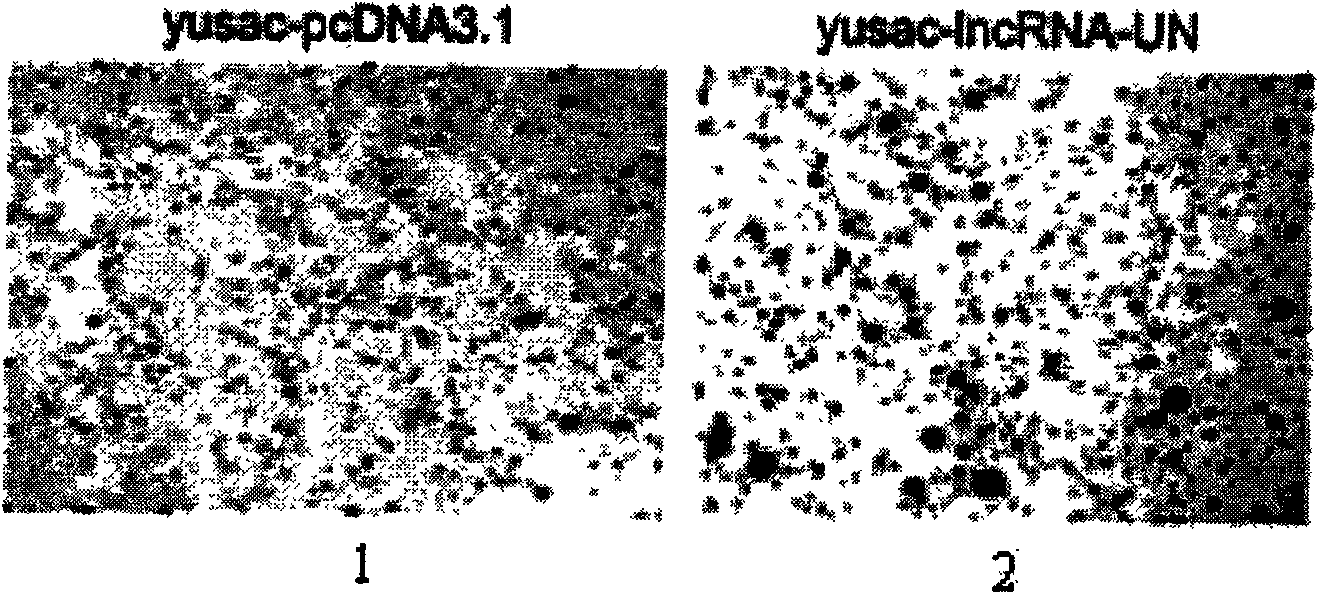 Long non-coding RNA sequence of human melanoma cell specific expression and application thereof