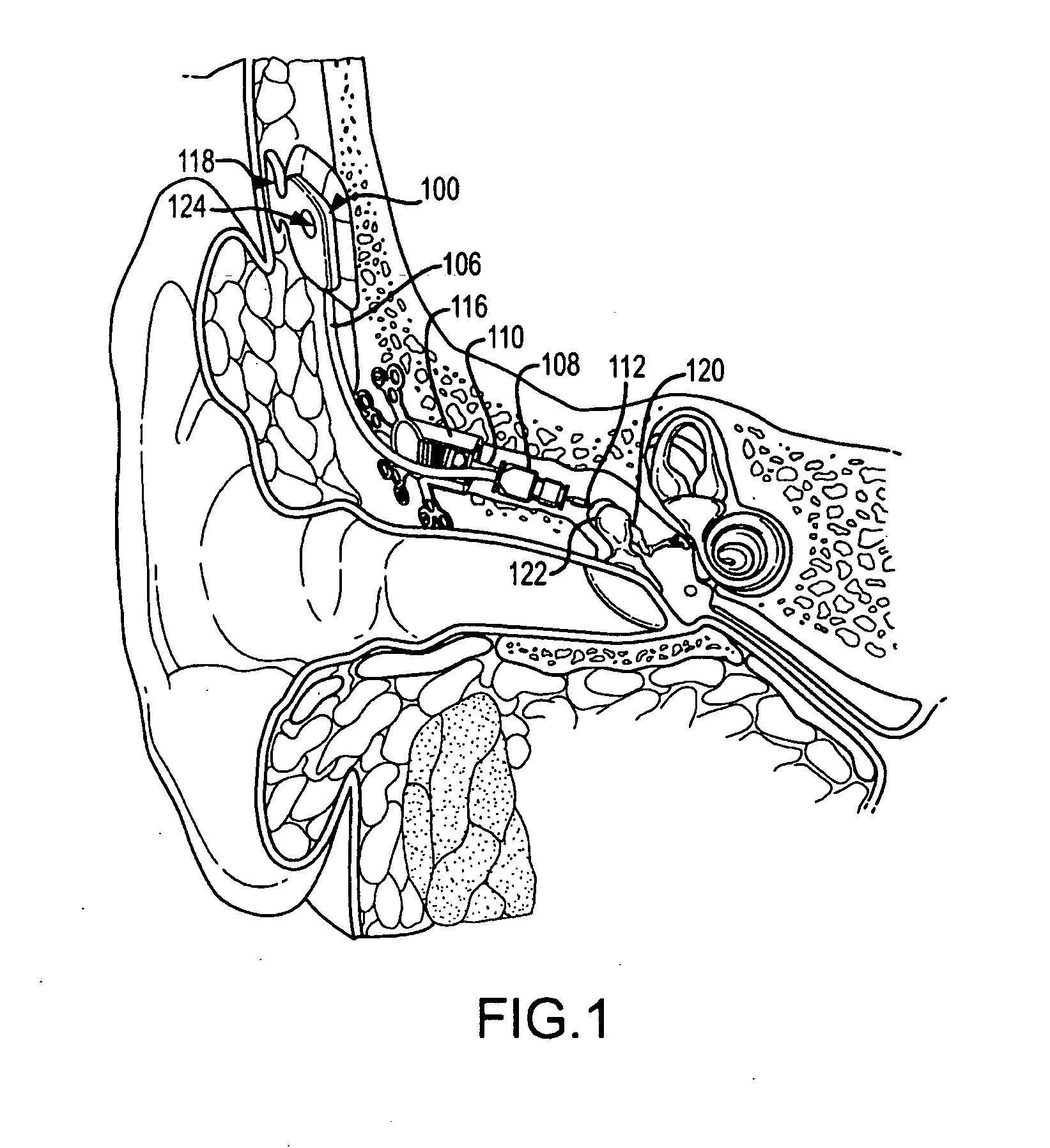 Fluid cushion support for implantable device