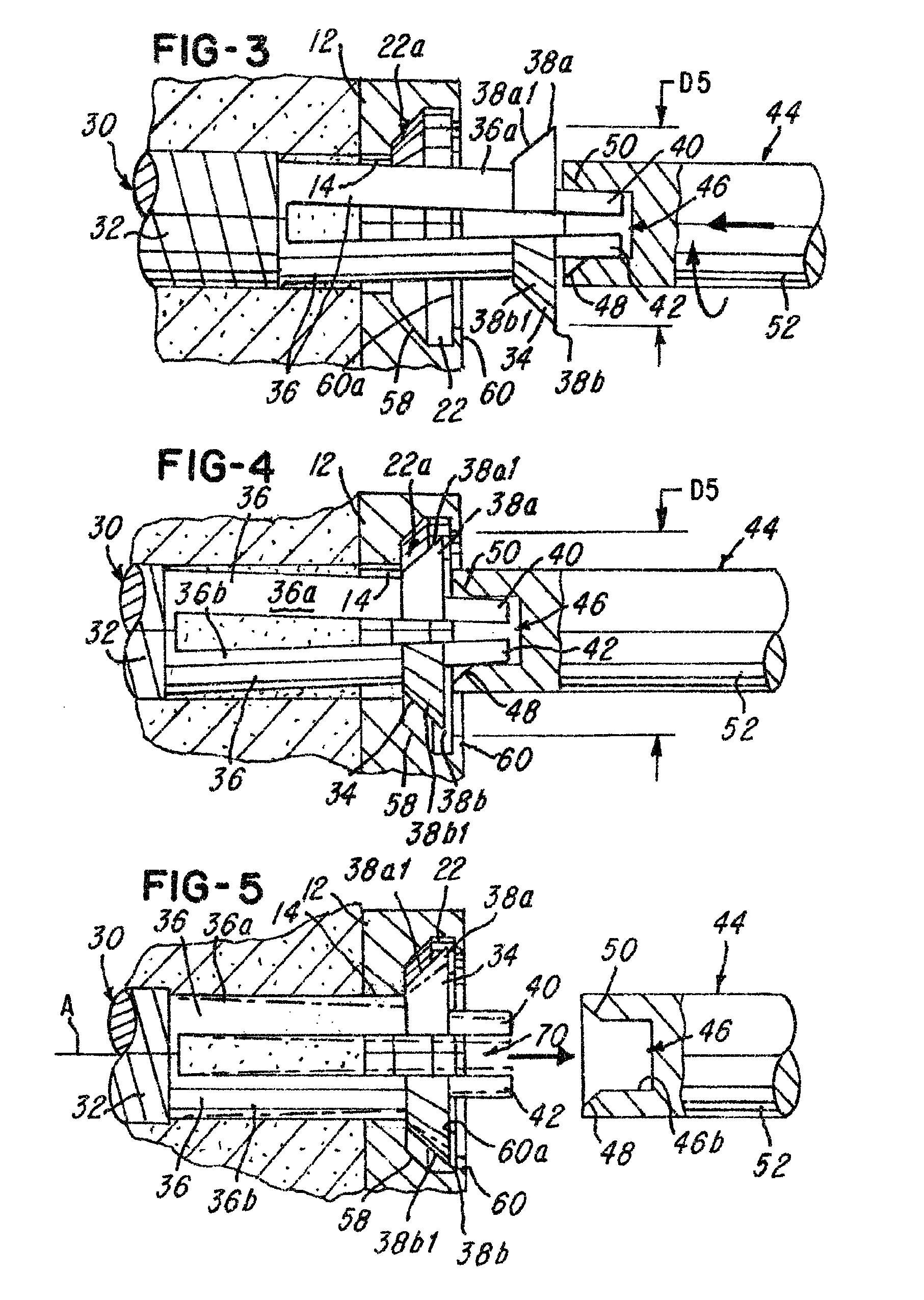 Screw implant and system and method for locking a screw in an implant plate