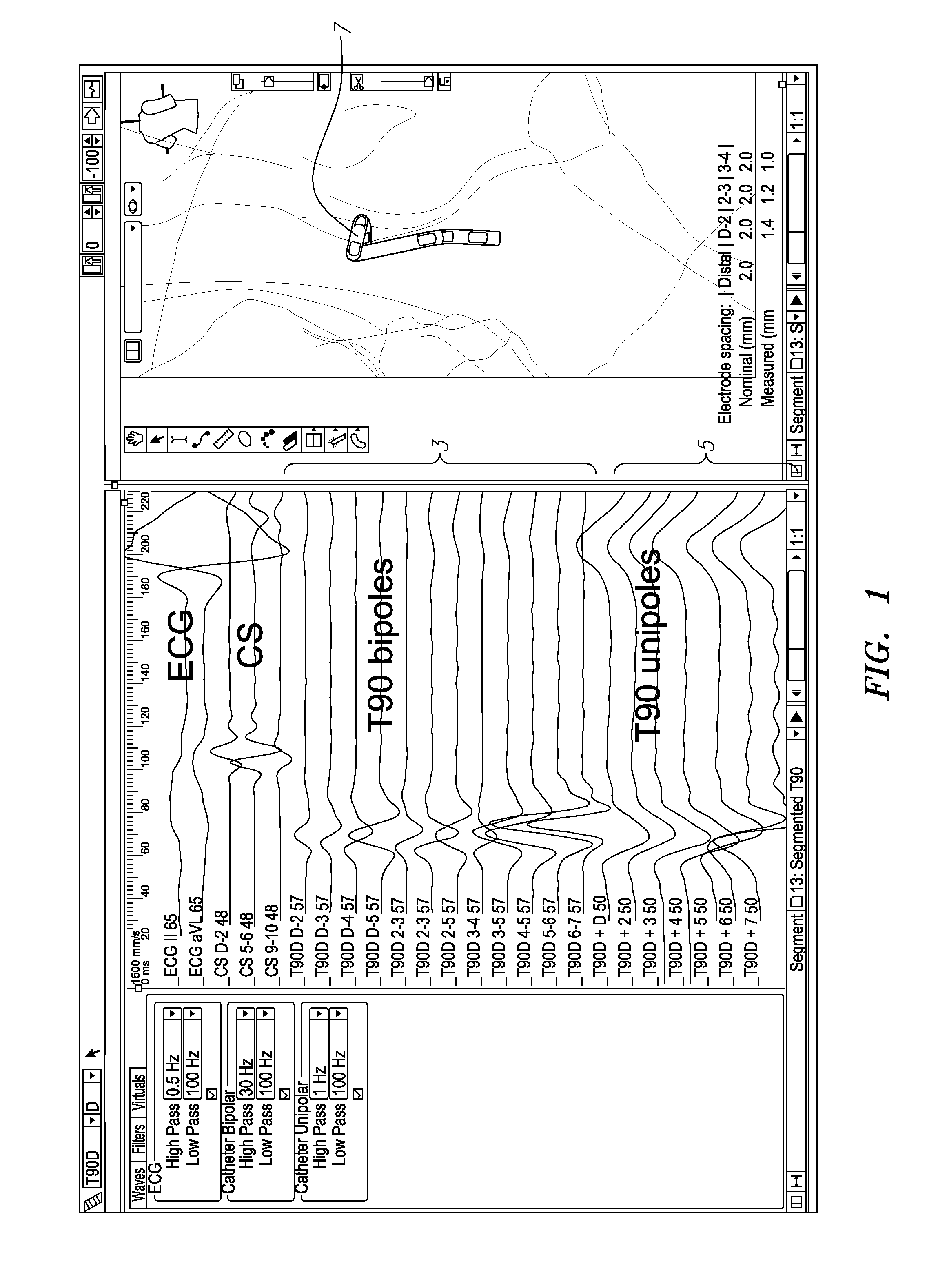 Systems and methods for using electrophysiology properties for classifying arrhythmia sources