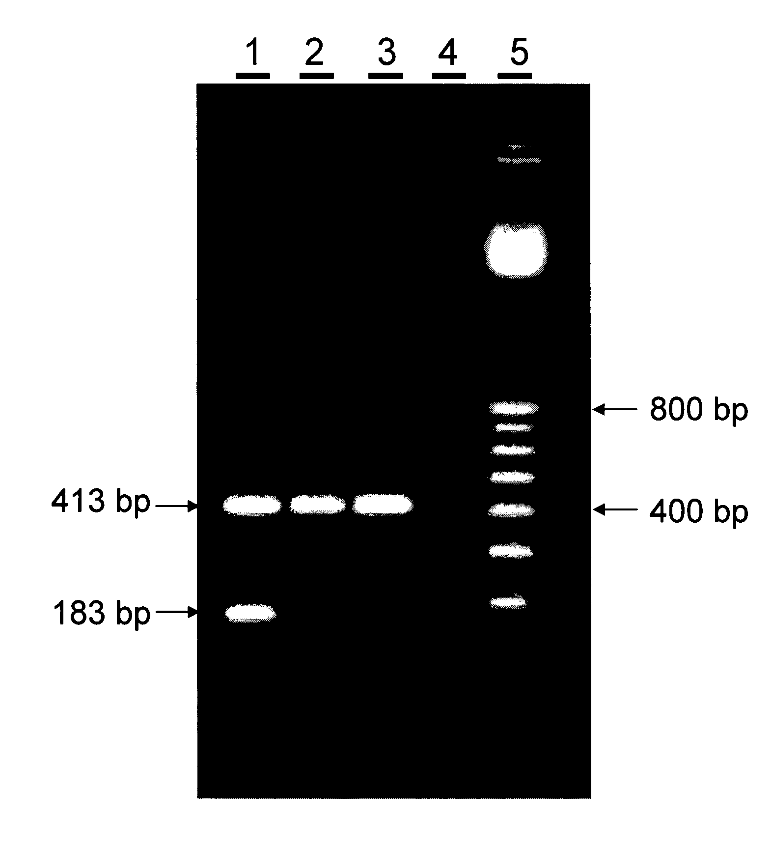 Elite Event A2407-12 and Methods and Kits for Identifying Such Event in Biological Samples