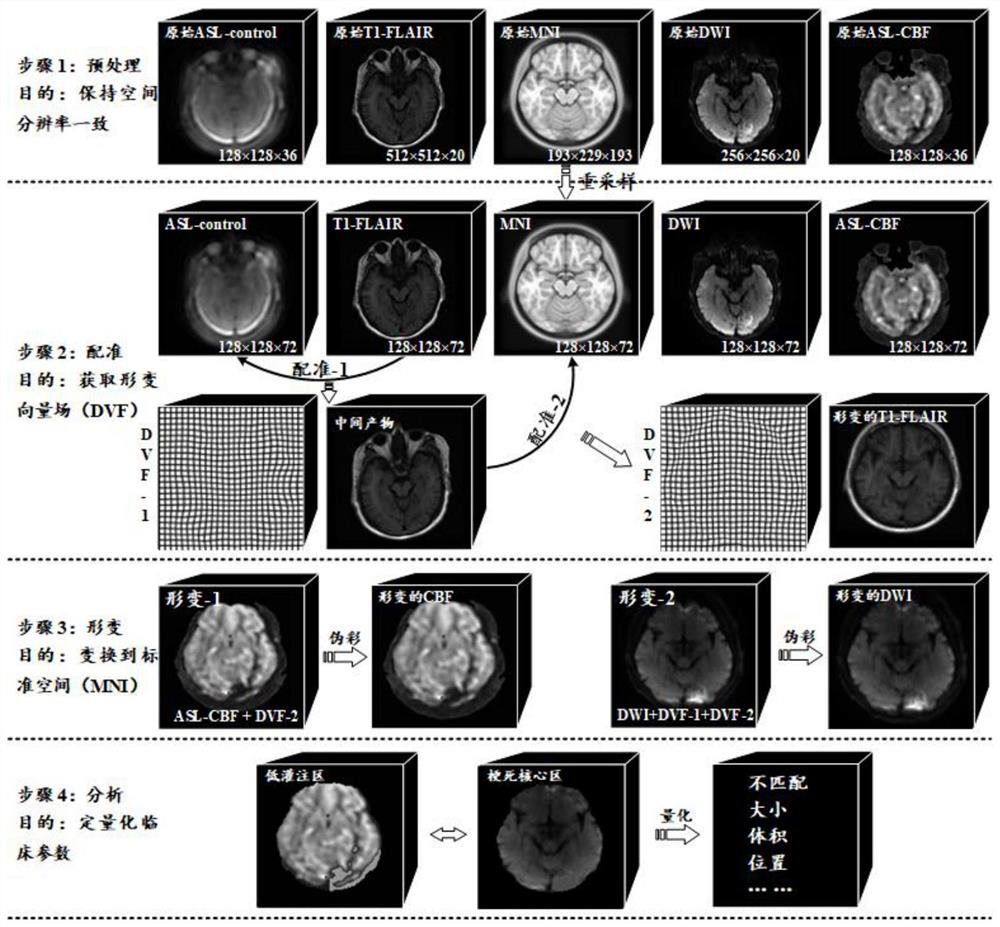 A registration method for MRI perfusion-diffusion images in acute ischemic stroke