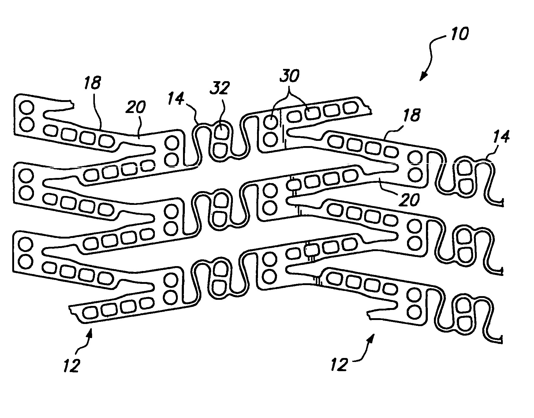 Expandable medical device with improved spatial distribution