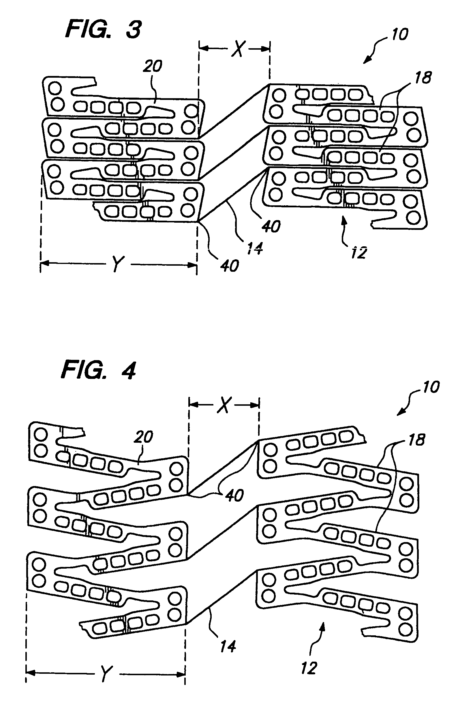 Expandable medical device with improved spatial distribution