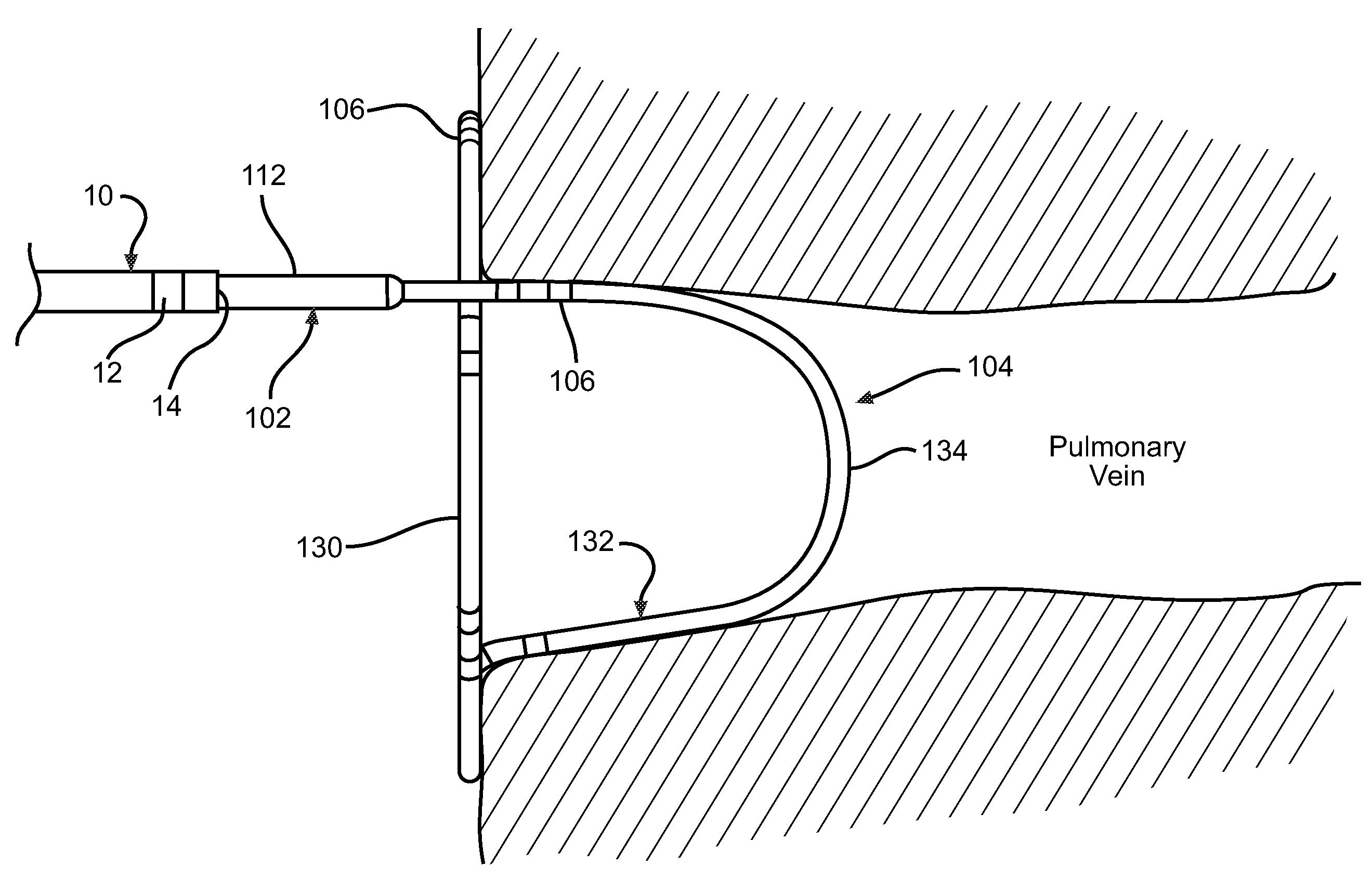 Loop Structures For Supporting Diagnostic and/or Therapeutic Elements in Contact With Tissue
