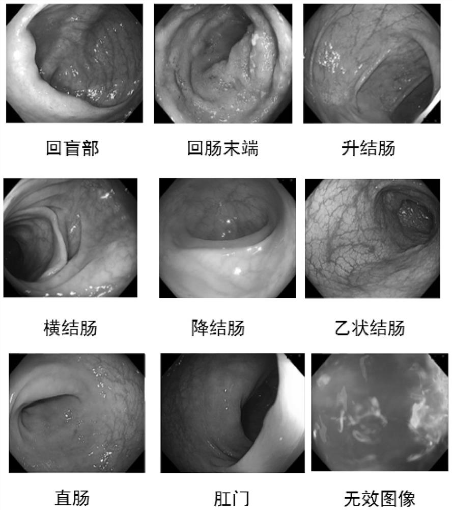 Monitoring method and device for intestinal endoscopy