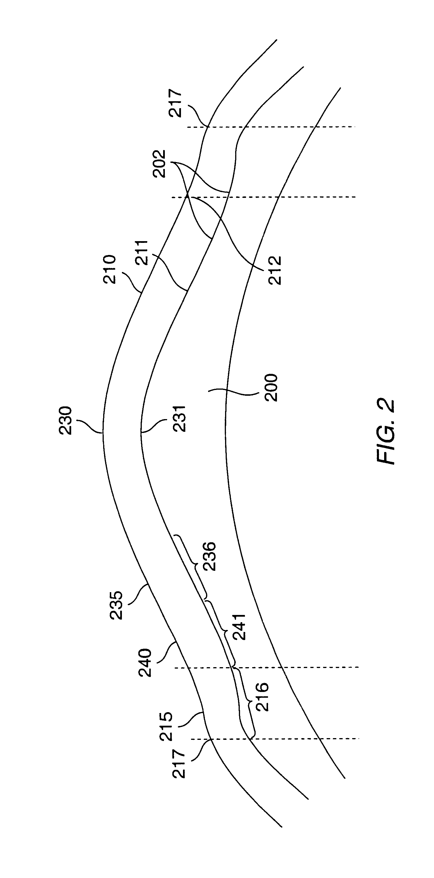 Method and systems for laser treatment of presbyopia using offset imaging