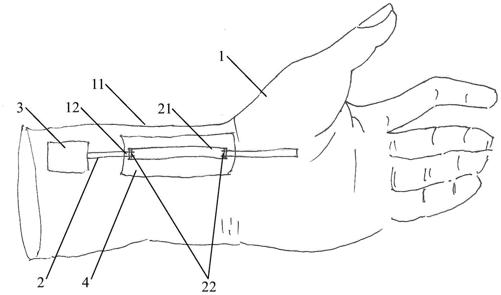 Radial artery puncture practice model and method