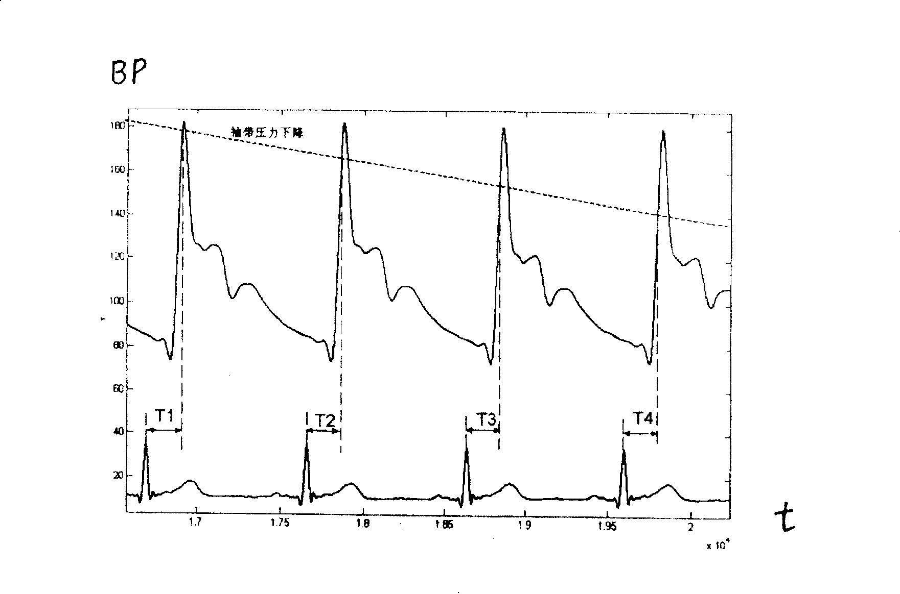 Detection method for blood pressure monitor with korotkoff sound delaying and pulse wave conducting time, and signal generator applying the same