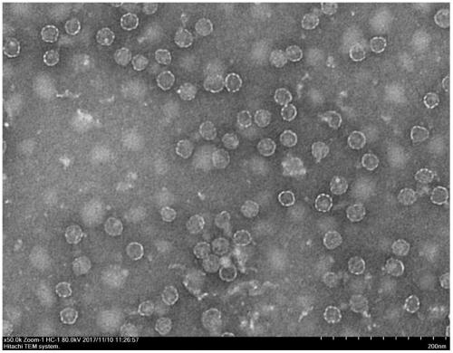 Chimeric bivalent blood-pressure-reduction vaccine for human vascular smooth muscle cell L-type calcium channels and angiotensin 1-type receptors and application thereof