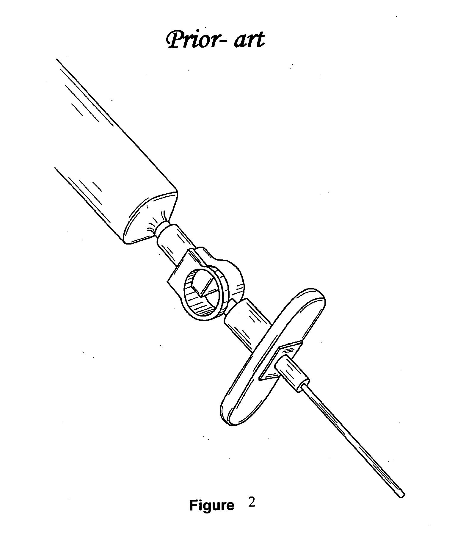 Device for locating epidural space while safeguarding against dural puncture through differential friction technique
