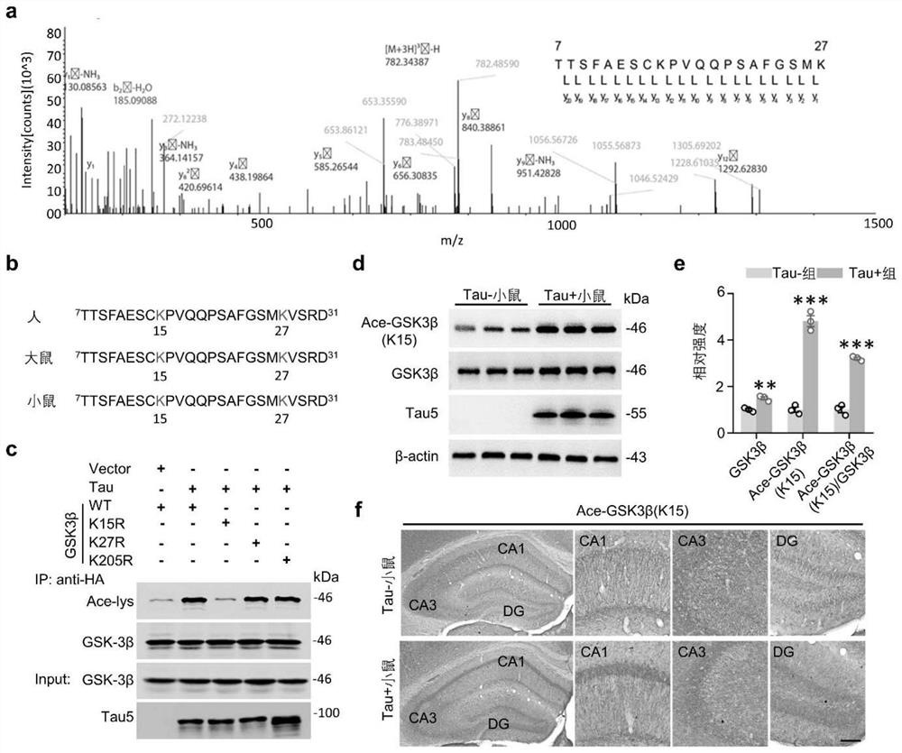 Polypeptide for inhibiting glycogen synthase kinase-3[beta] acetylation, coding gene of polypeptide and application of polypeptide and coding gene