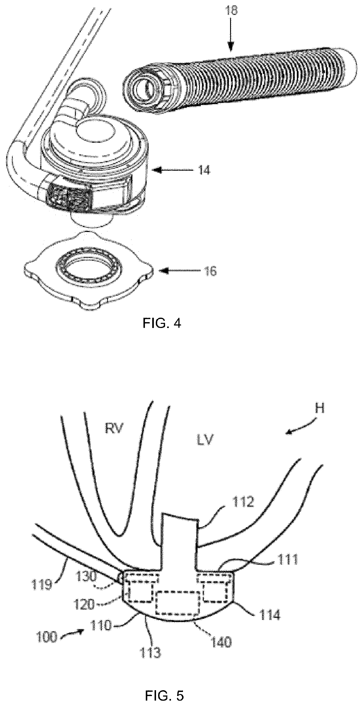 Mechanical gauge for estimating inductance changes in resonant power transfer systems with flexible coils for use with implanted medical devices
