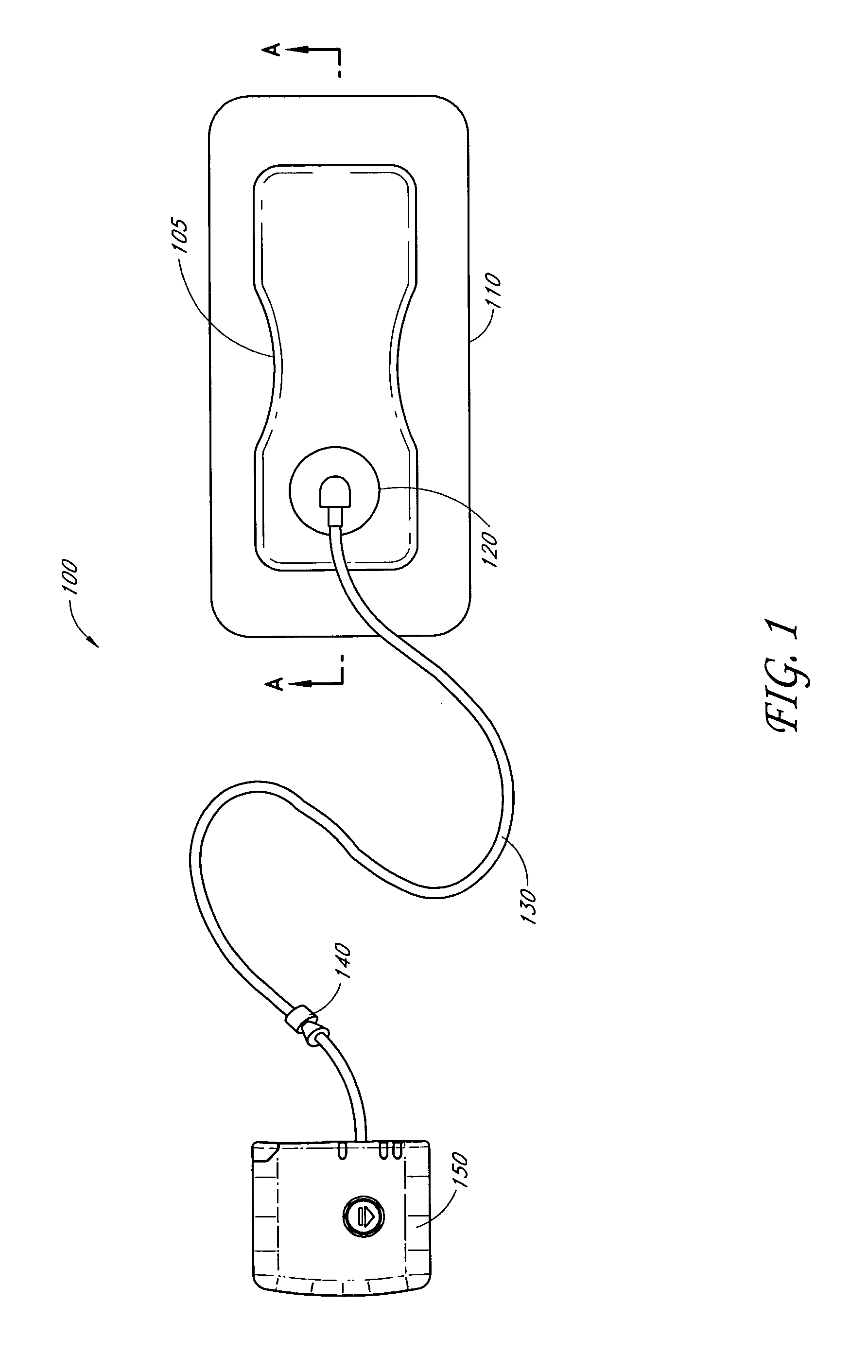 Wound dressing and method of treatment