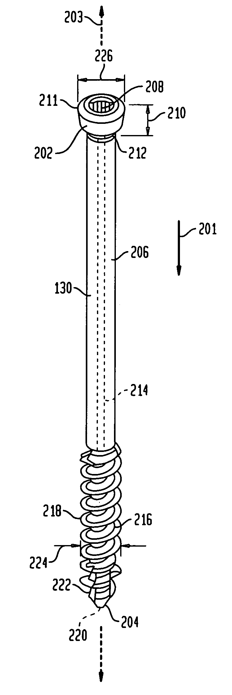 Intraosseous intramedullary fixation assembly and method of use