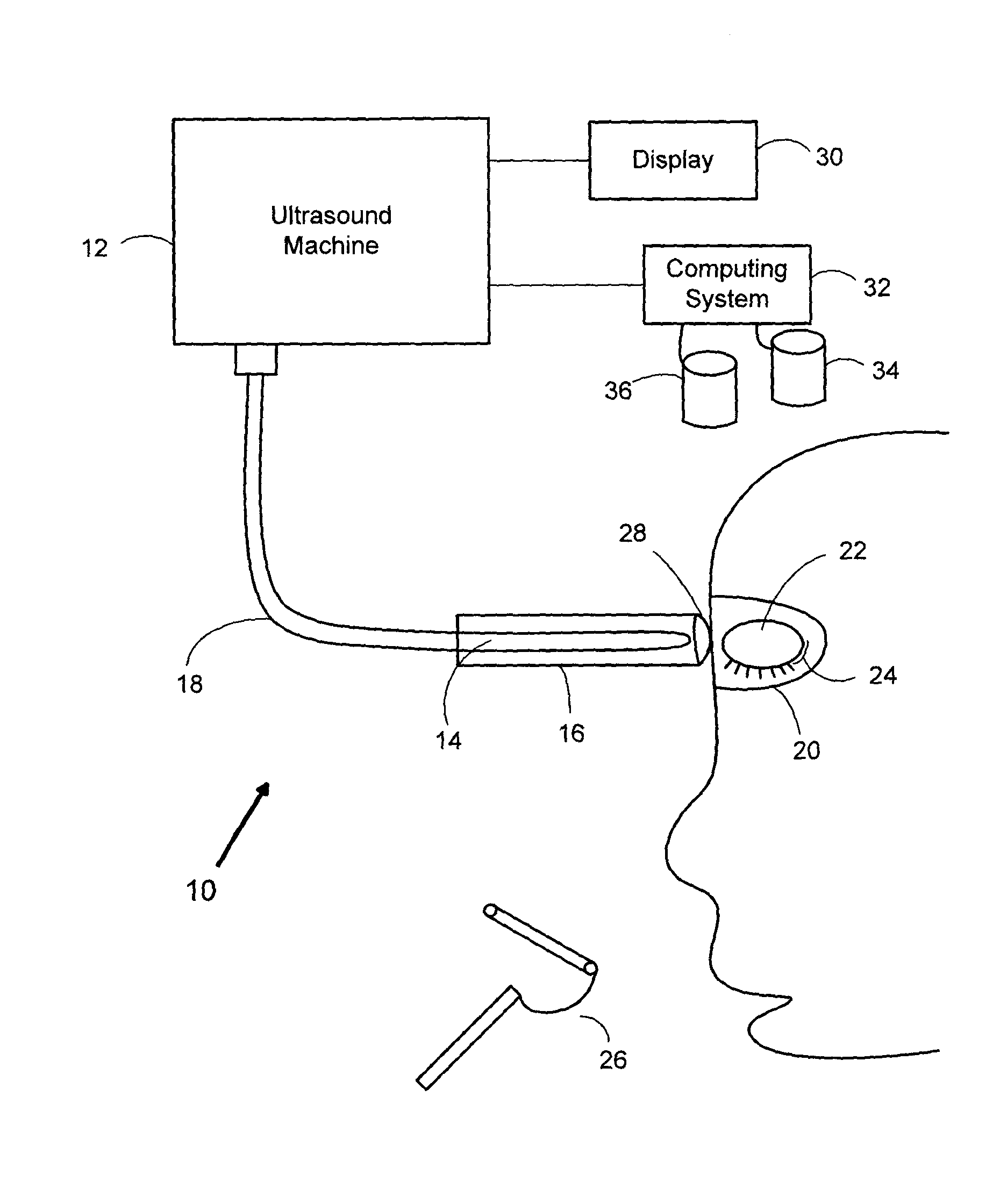 Method, system and use for therapeutic ultrasound