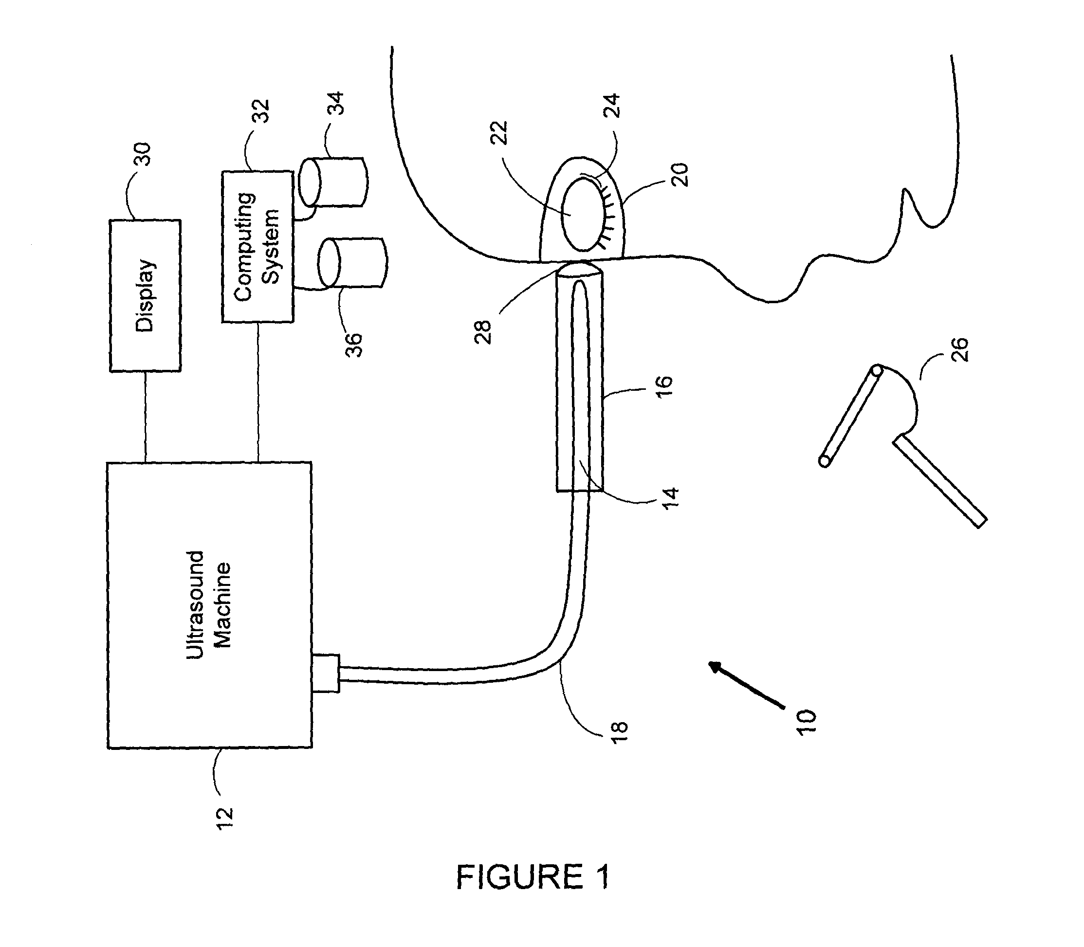 Method, system and use for therapeutic ultrasound