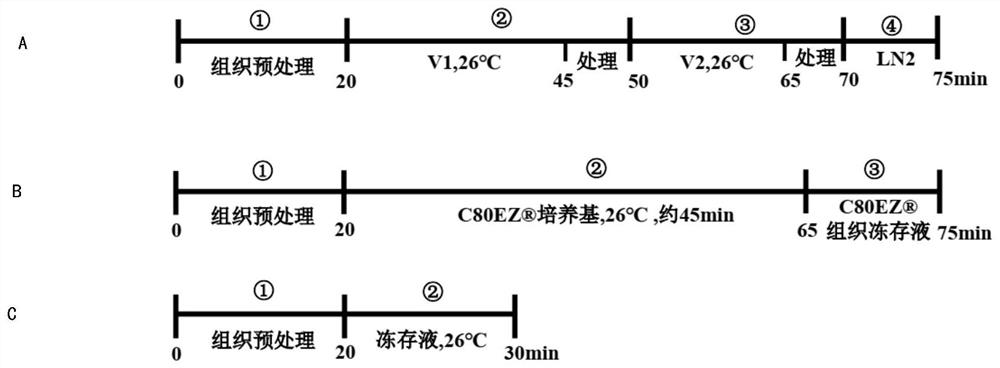 Whole-drug-grade raw material tumor tissue cryopreservation liquid and application thereof