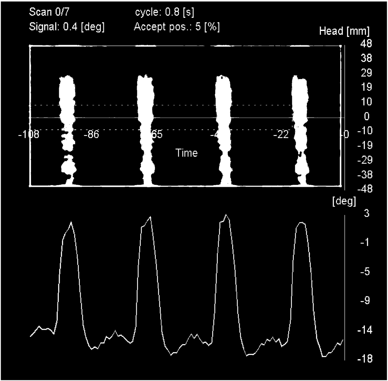 Prospective electrocardiography triggering method and device