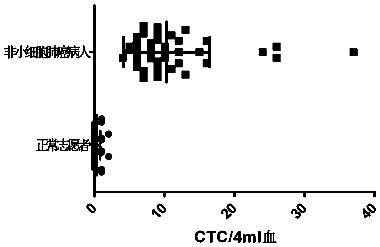 Recombinant herpes simplex virus hsv-htertp_icp4_lungca-gfp and diagnostic kit