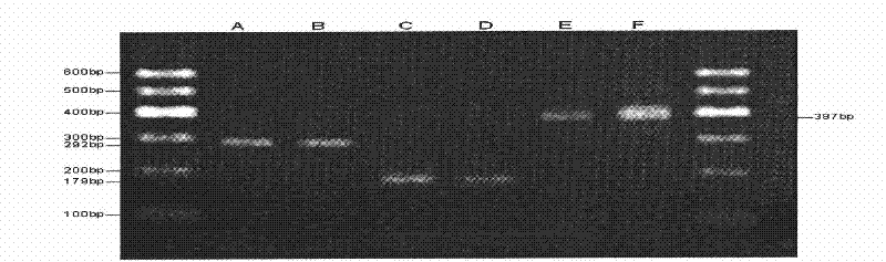 Method for breeding cattle through polymorphism of angiopoietin-related protein 4 (ANGPTL4) gene