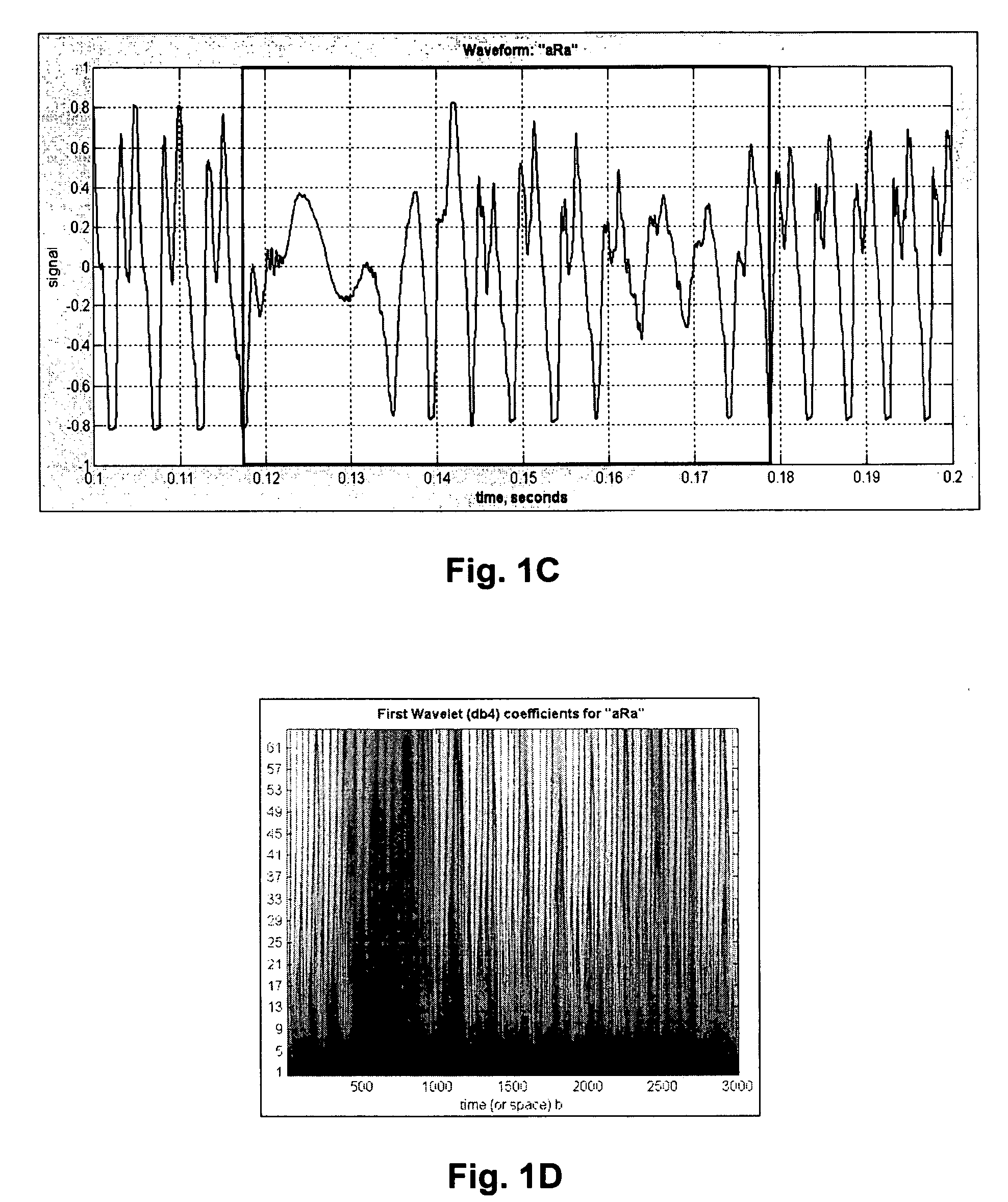 Accent detection and correction system