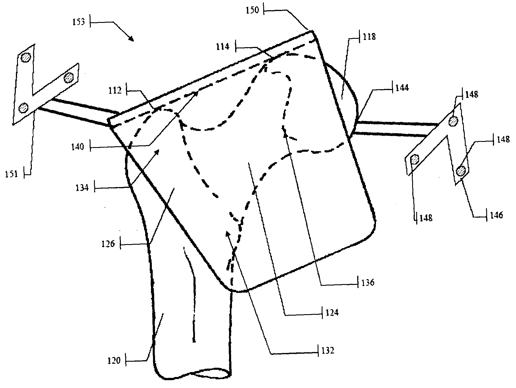 Method and Apparatus for Computer-Assisted Femoral Head Resurfacing