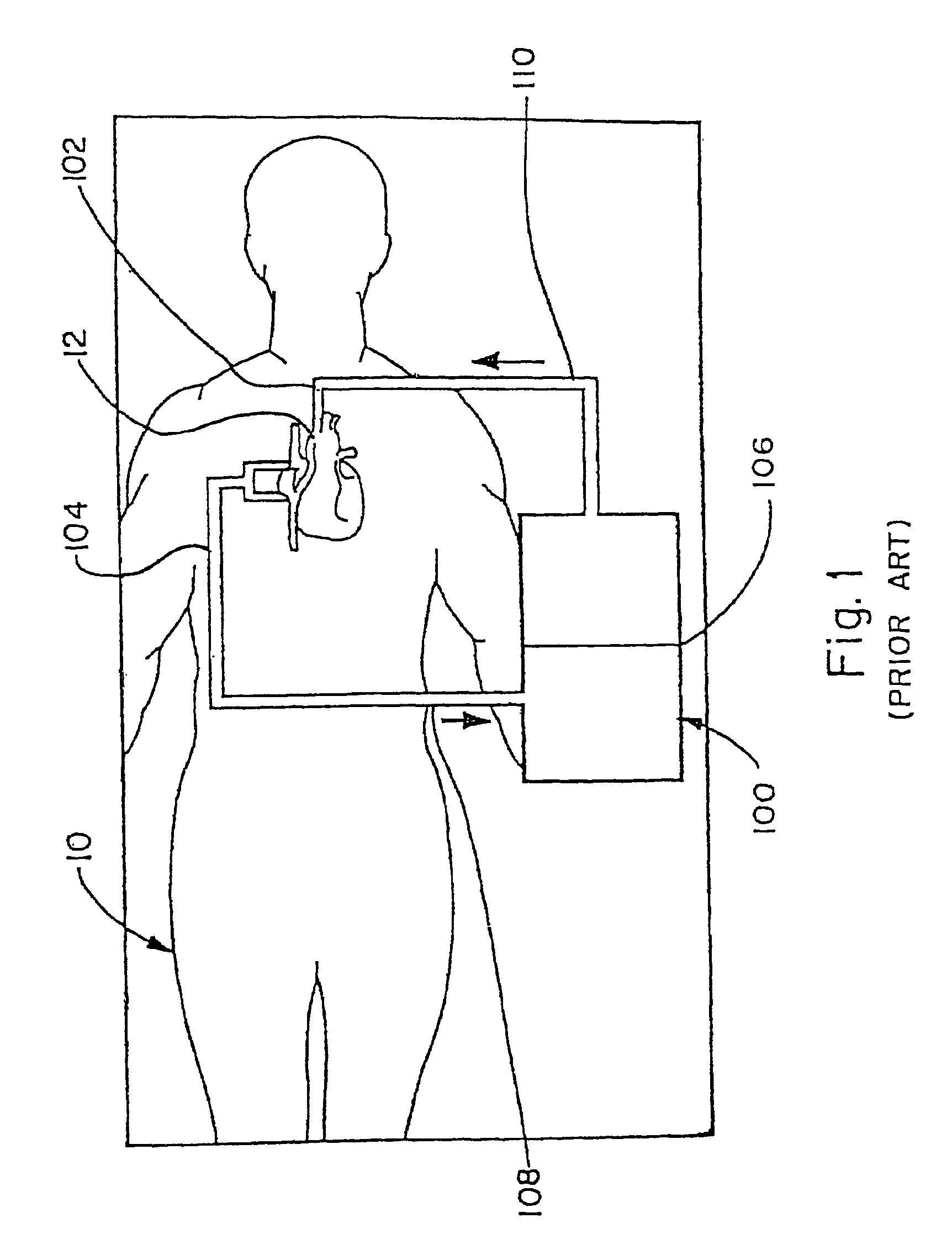 CPB system with dual function blood reservoir