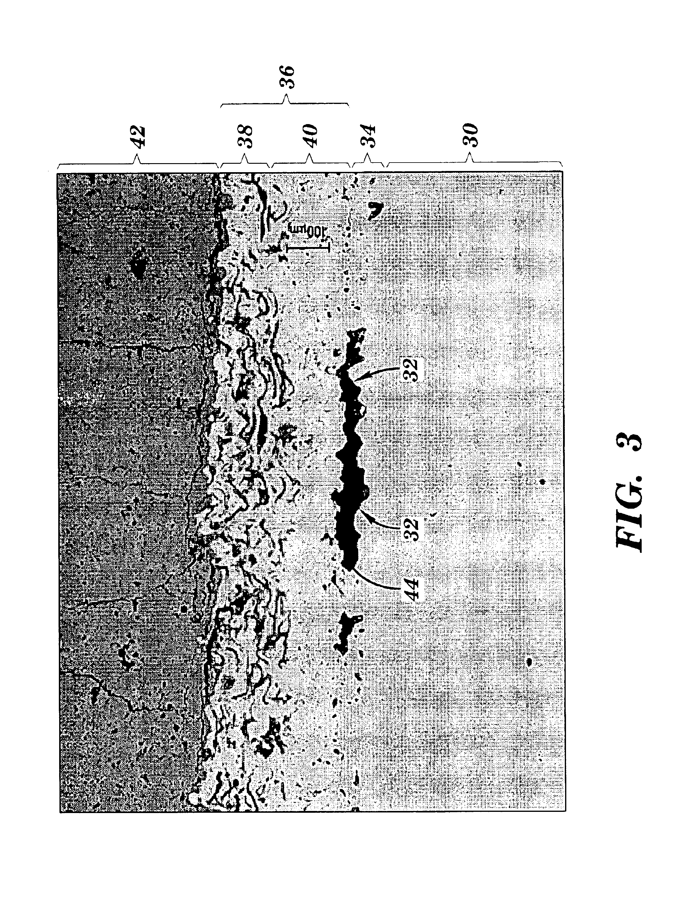 Method for forming a channel on the surface of a metal substrate