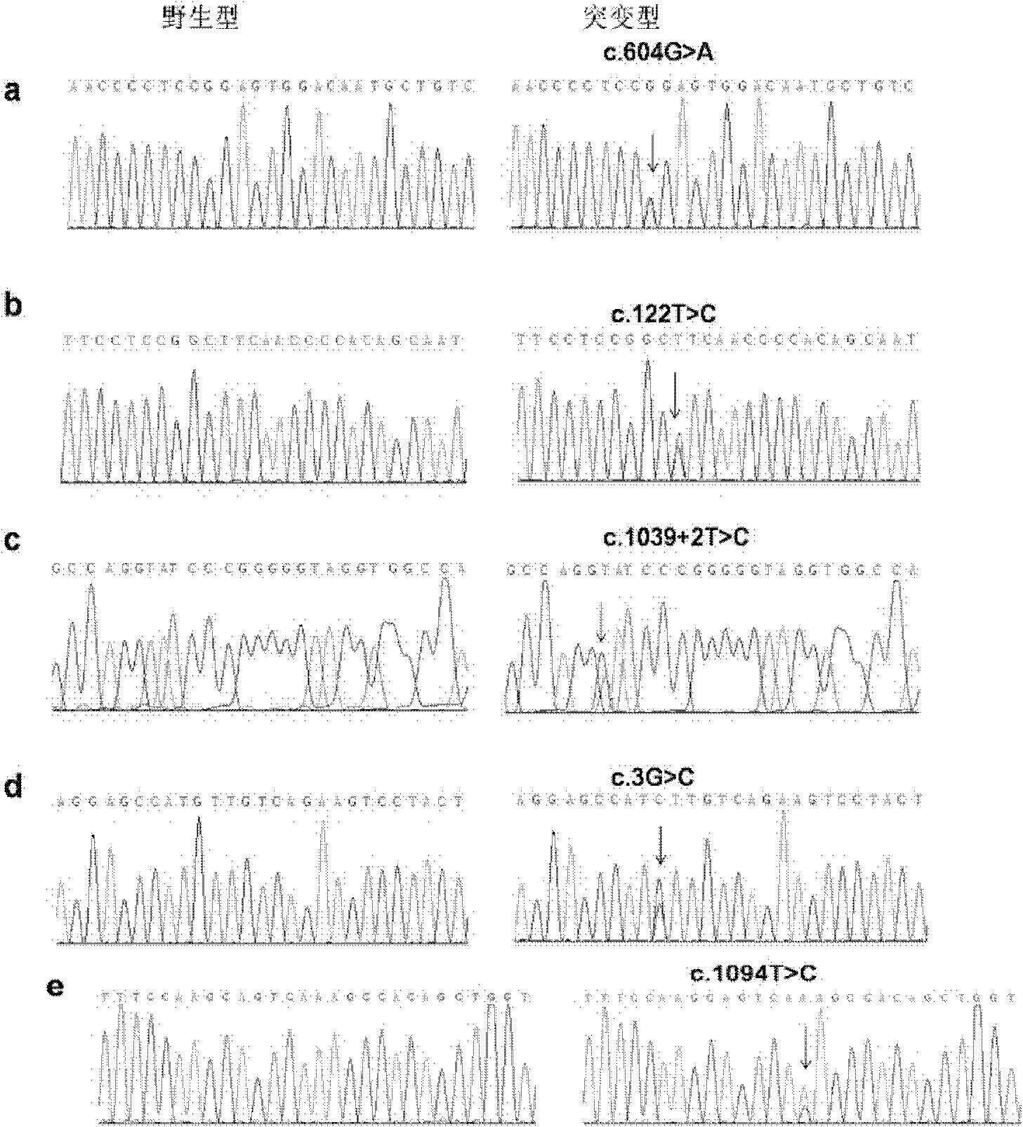 Disseminated superficial actinic porokeratosis (DSAP) related gene