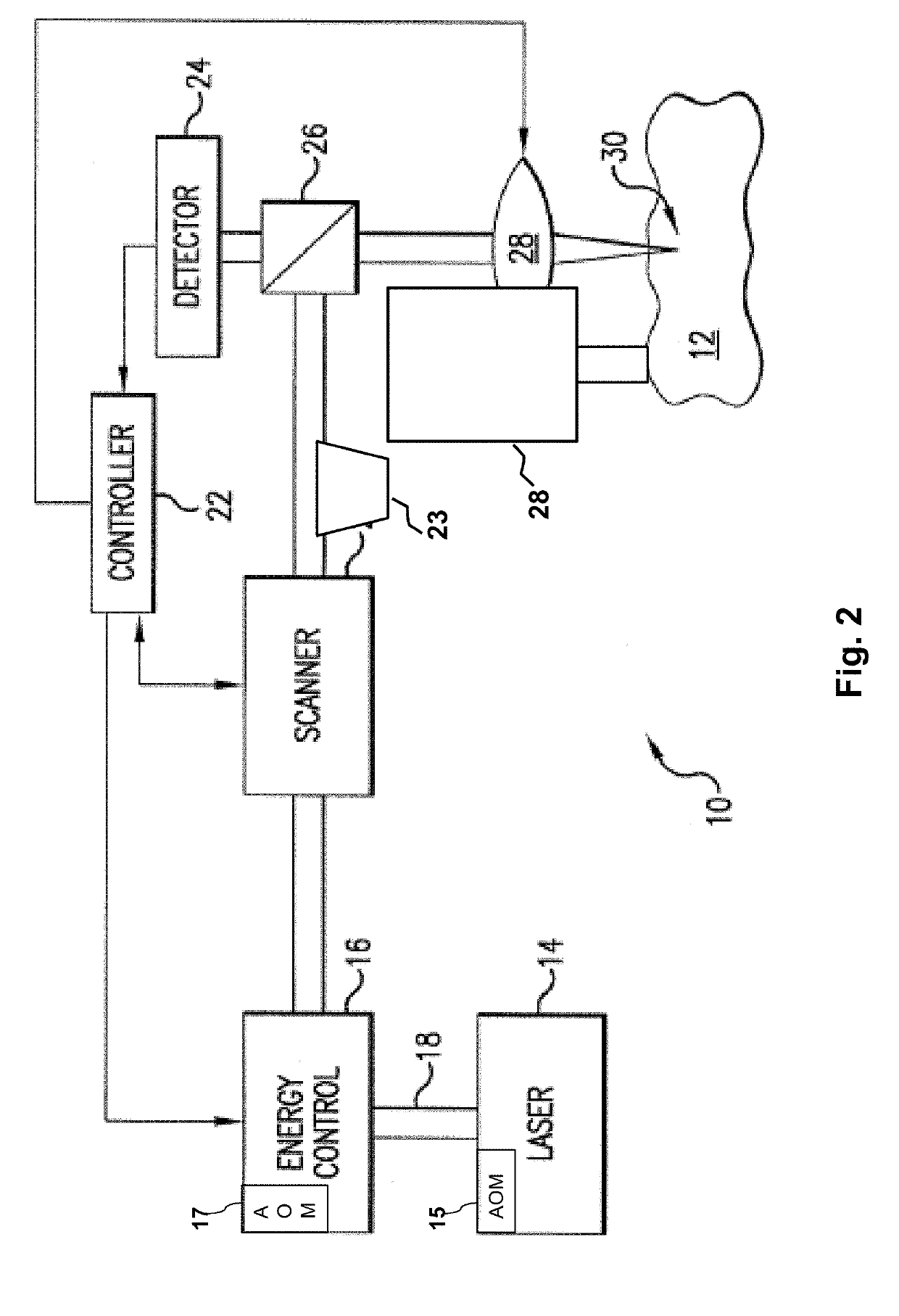 Systems and methods for high speed modulation of a resonant scanner in ophthalmic laser applications