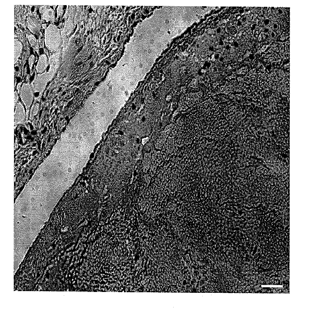 Accelerating Thrombus Resolution Through Augmentation of p53 Activity