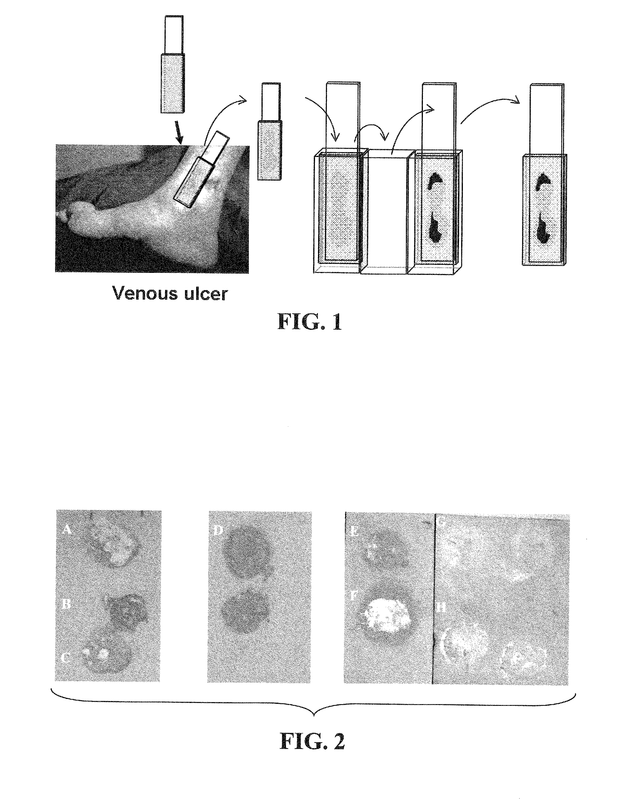 Materials and Methods for Assessing and Mapping Microbes and Microbial Biofilms on Wounds