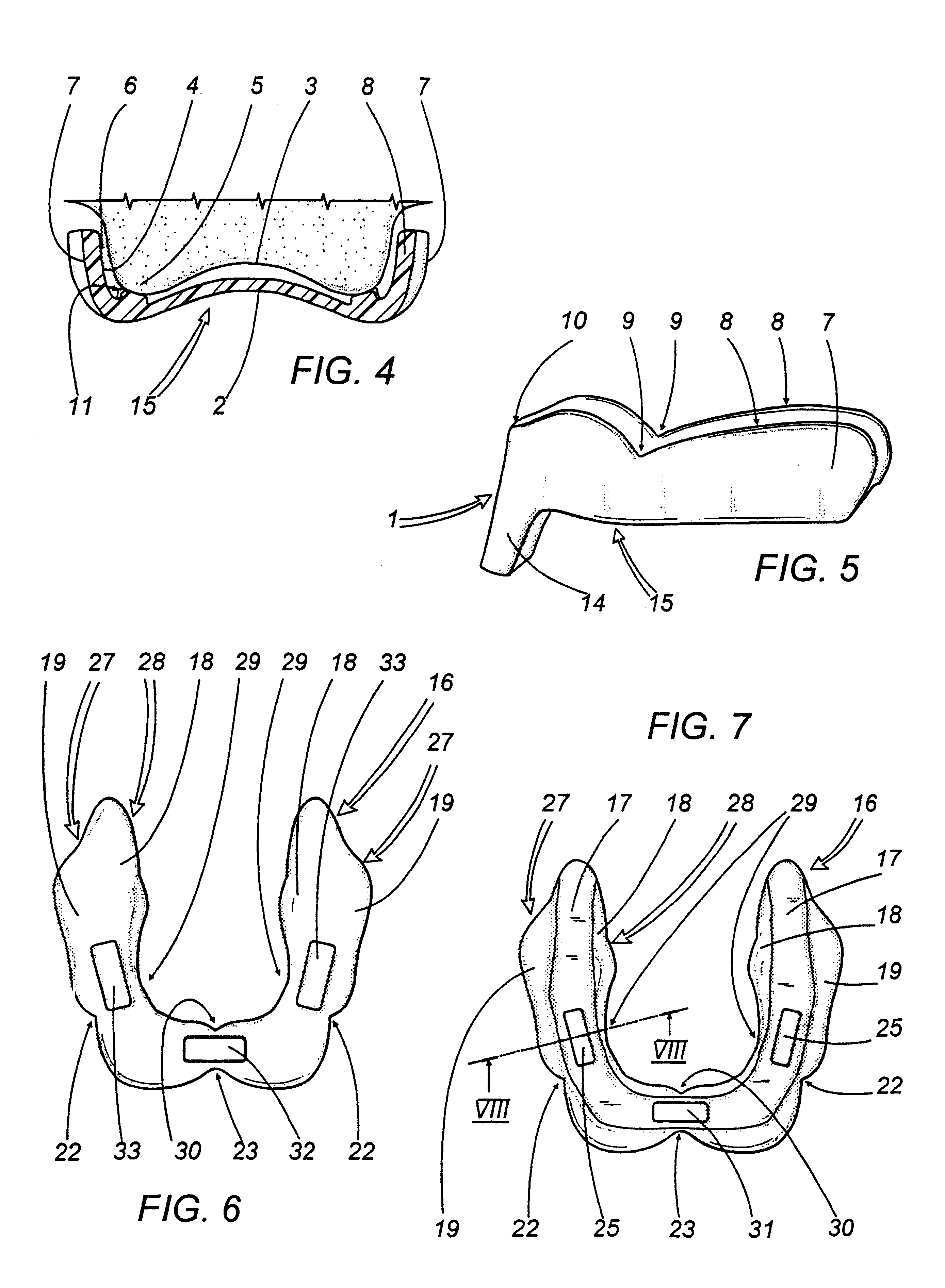 Series of single-use print holders for edentulous patients and method for the realization of total prostheses
