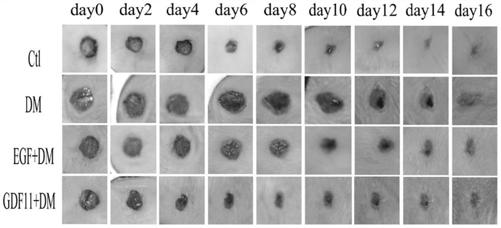 Application of Growth Differentiation Factor-11 in Promoting Diabetic Wound Healing
