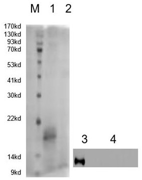 Single-domain antibody HCV-E2 of hepatitis C virus E2 protein and application of single-domain antibody HCV-E2