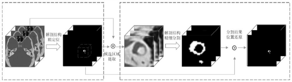 Temporal bone inner ear bone cavity structure automatic segmentation method based on coarse-to-fine dense coding and decoding network