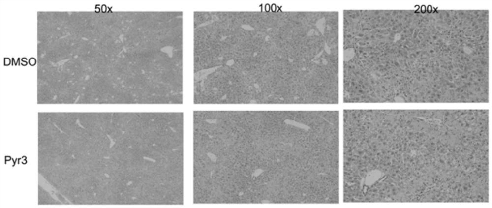 Application of pyr3 in the preparation of drugs for protecting liver damage