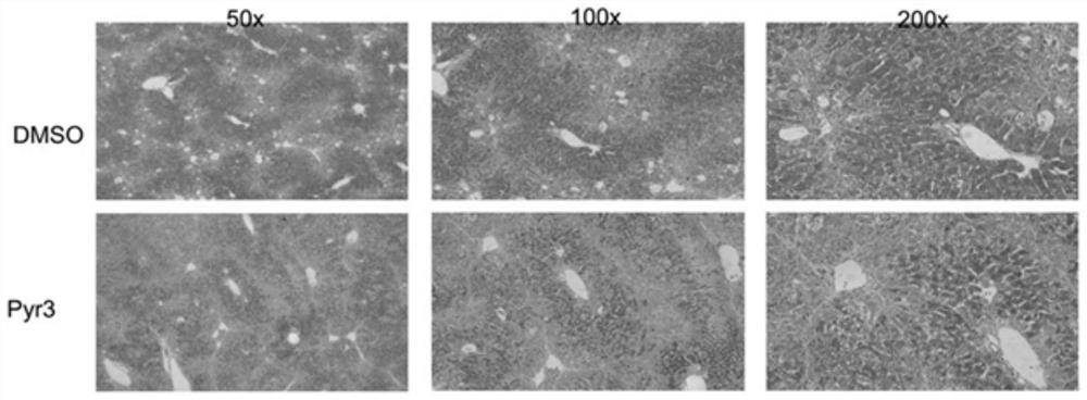 Application of pyr3 in the preparation of drugs for protecting liver damage