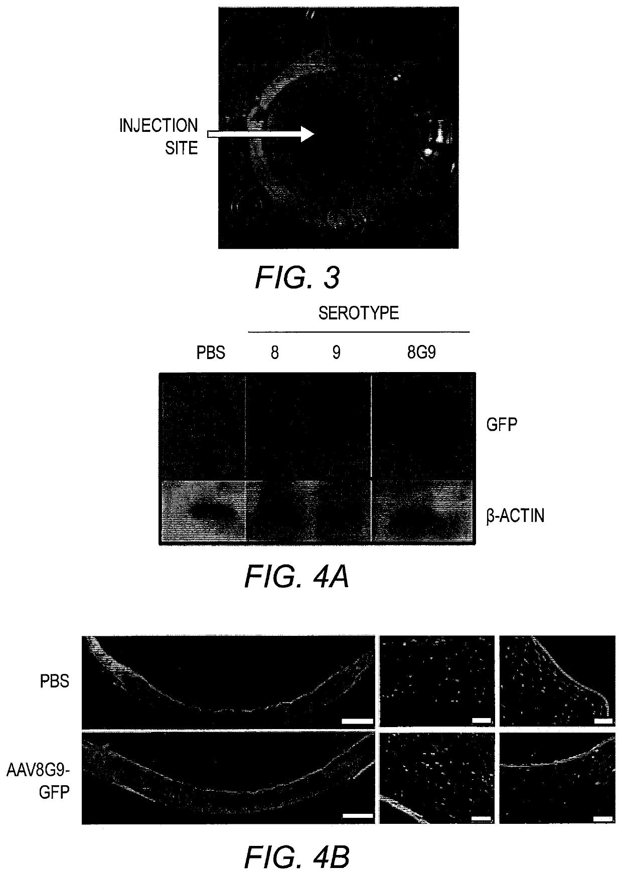 AAV-IDUA vector for treatment of MPS I-associated blindness