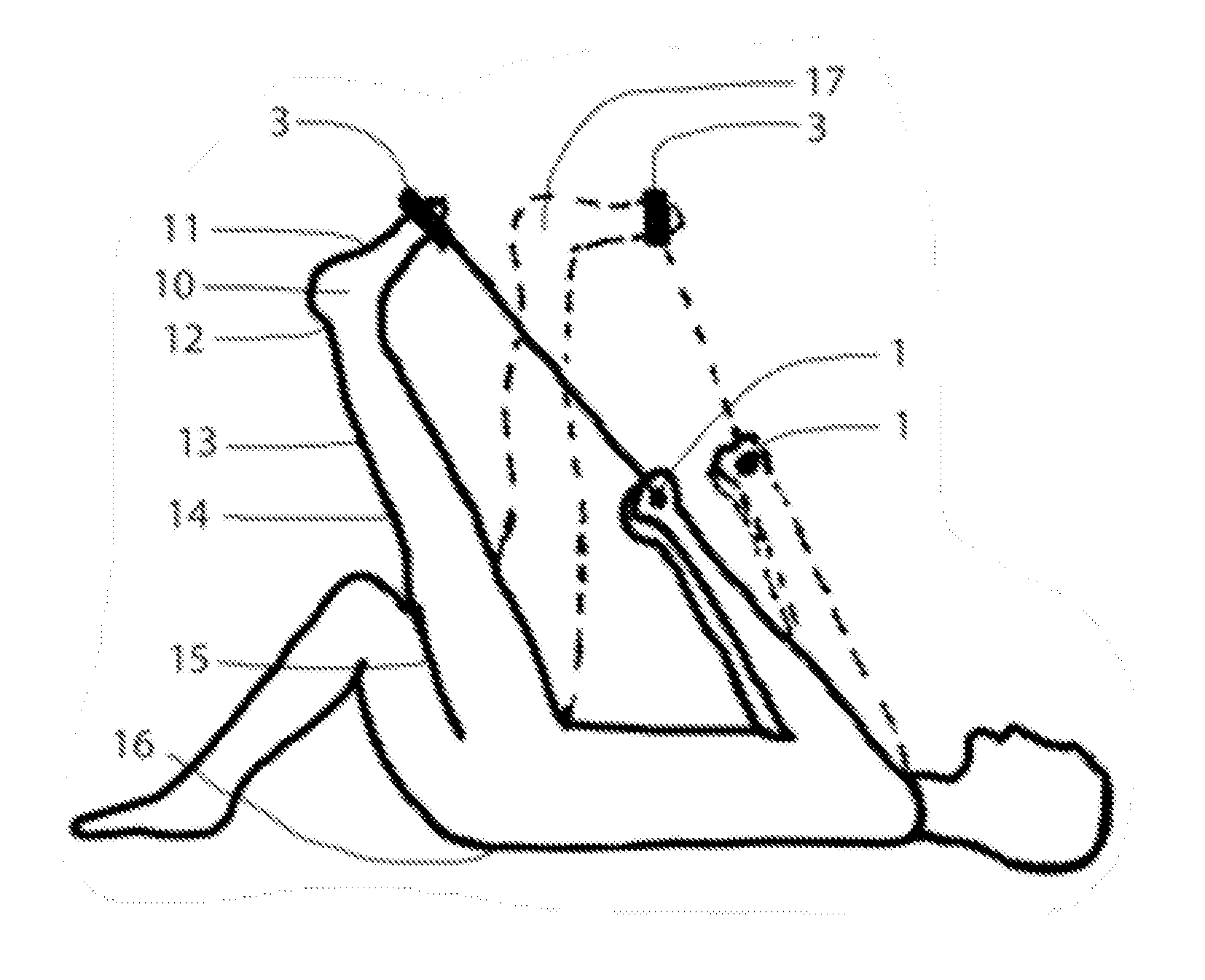 Handheld Extremity Flexibility Evaluation And Treatment Device