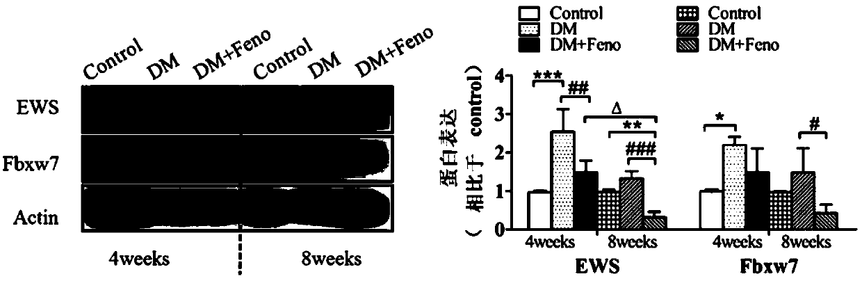 Application of Ewing sarcoma (EWS) or up-regulator thereof in preparing medicament for treating diabetes and preventing and treating tumorigenesis of diabetic individuals