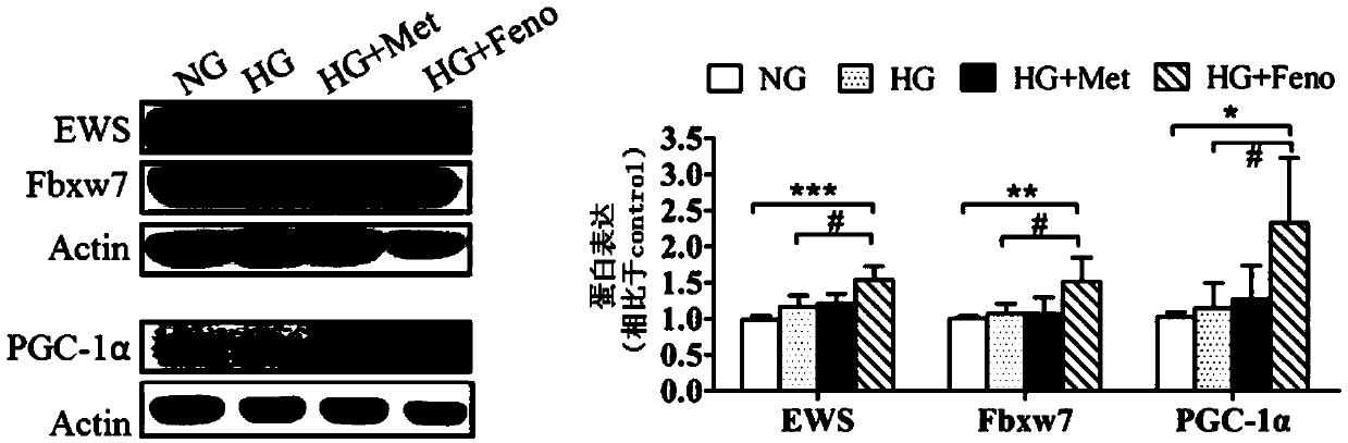 Application of Ewing sarcoma (EWS) or up-regulator thereof in preparing medicament for treating diabetes and preventing and treating tumorigenesis of diabetic individuals