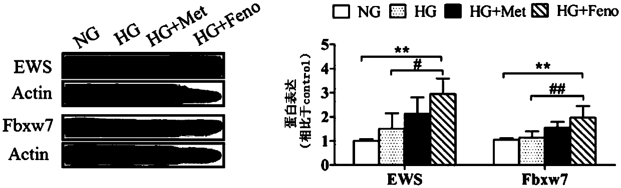 Application of Ewing sarcoma (EWS) or up-regulator thereof in preparing medicament for treating diabetes and preventing and treating tumorigenesis of diabetic individuals