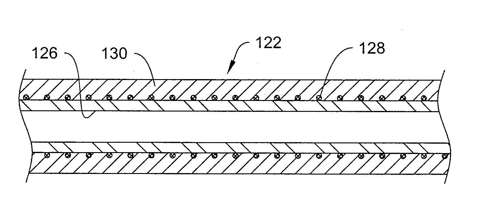 Catheter With Knit Section