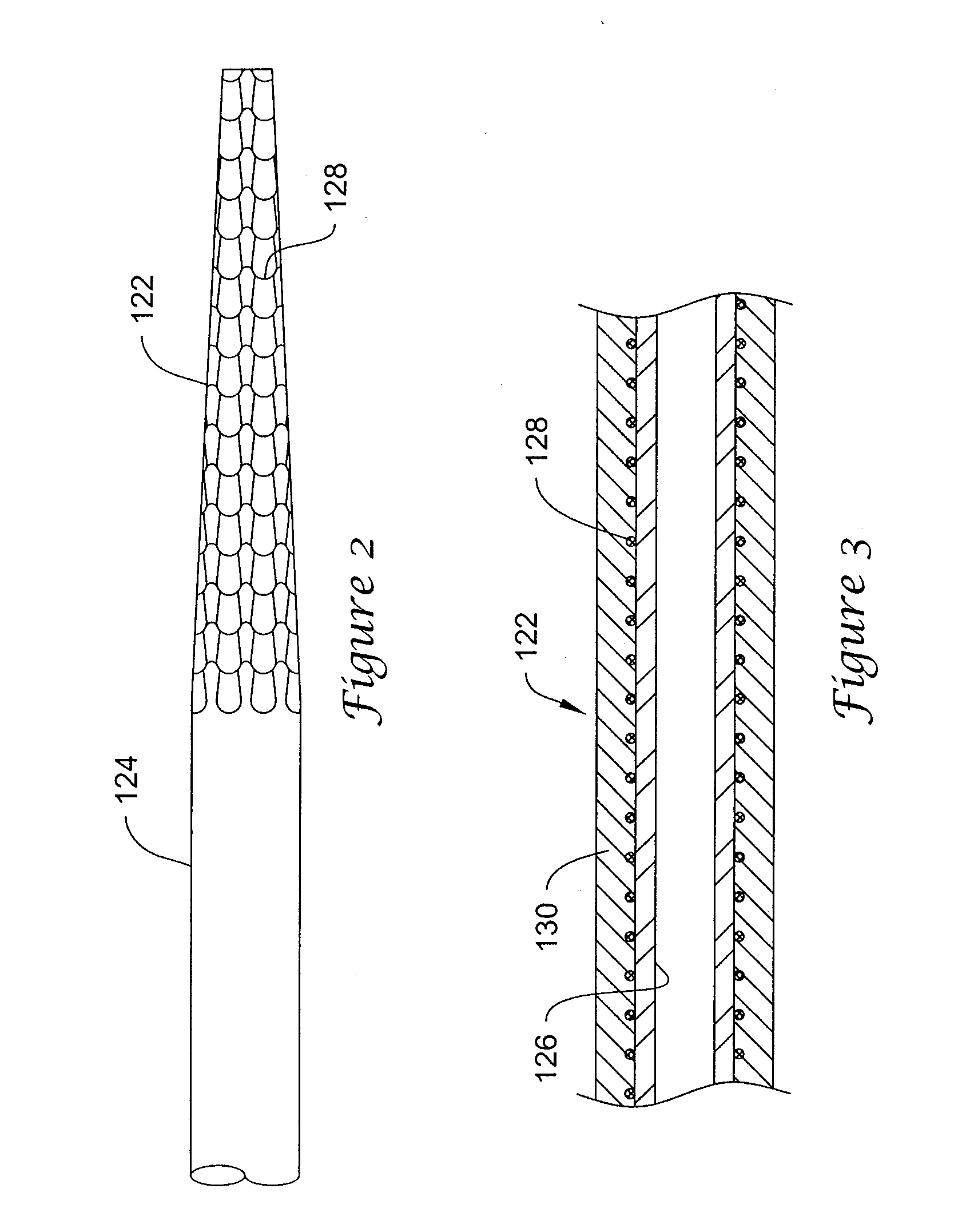 Catheter With Knit Section