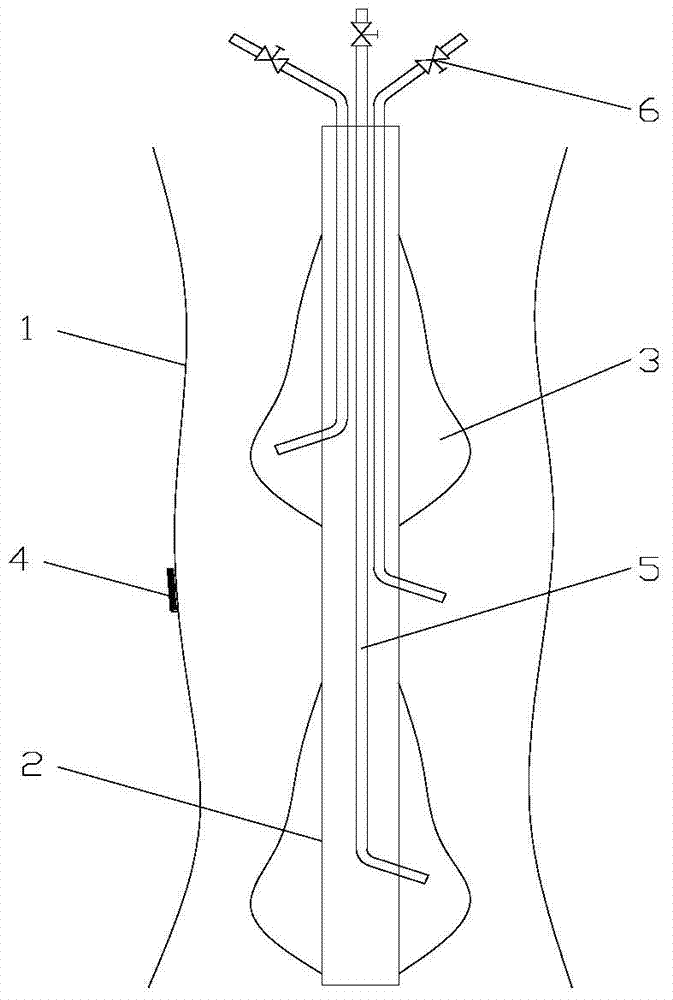 Leakage detecting device for digestive tract anastomotic stoma and leakage detecting method thereof