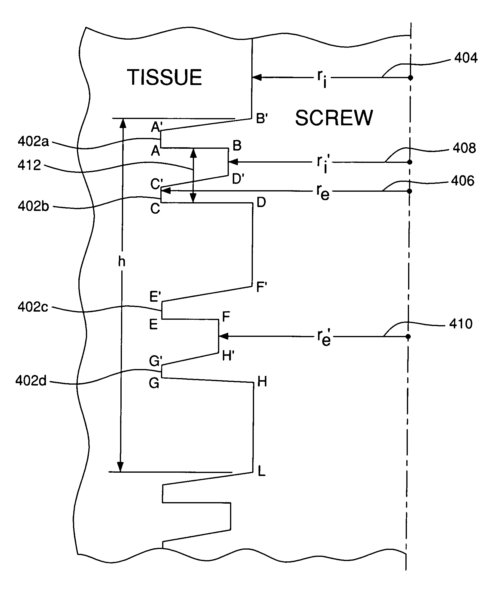 Osteointegrated implant systems