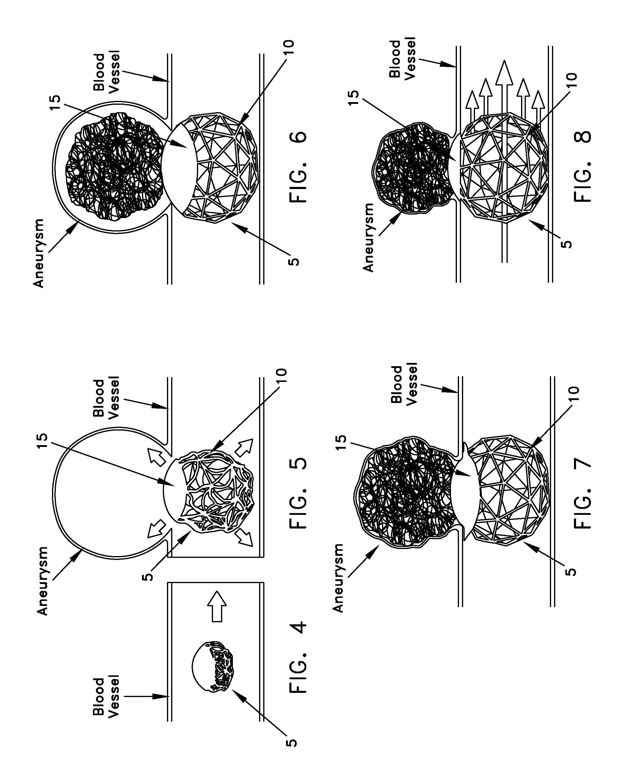 Method and apparatus for restricting flow through an opening in the side wall